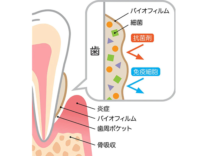 蟹江町（愛知県）の歯医者、あじさいデンタルクリニックの予防歯科